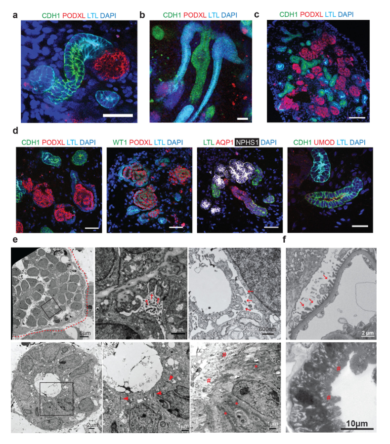 3D kidney organoid microscopy and electron microscopy panels